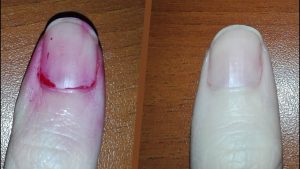 Quitar esmalte de uñas rojas